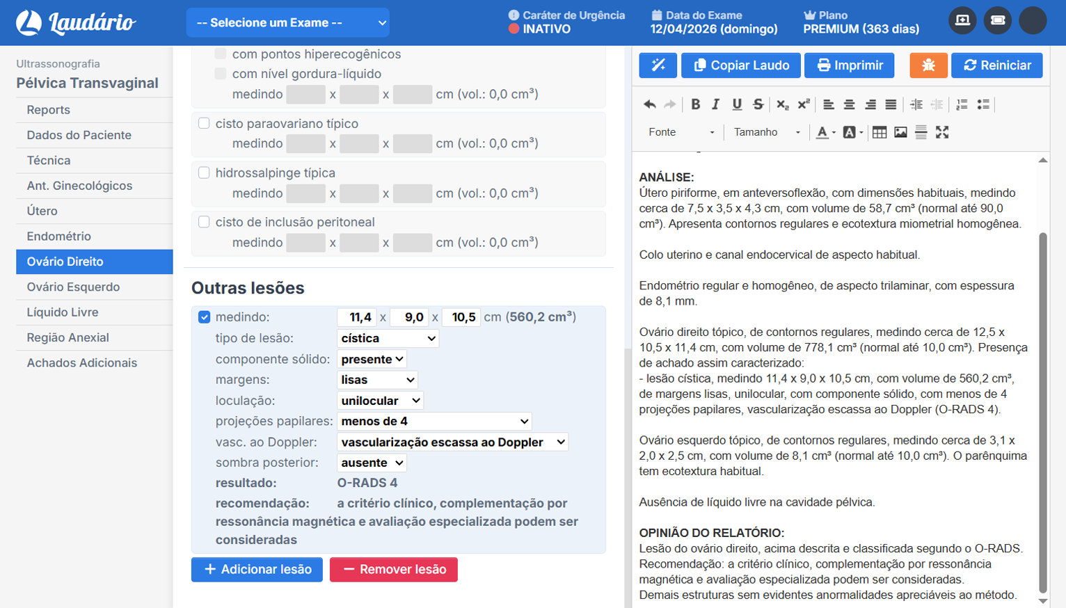 Classificação automática de O-RADS