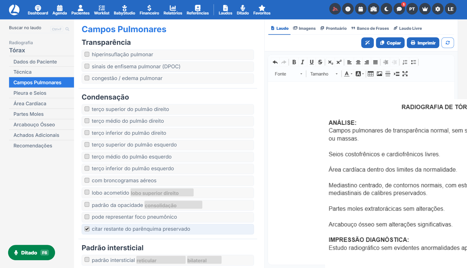 Prévia do Laudário Radiografia