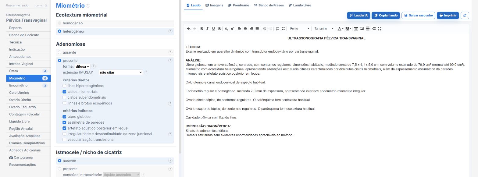 Pantalla de Laudário: adenomiosis por los criterios MUSA