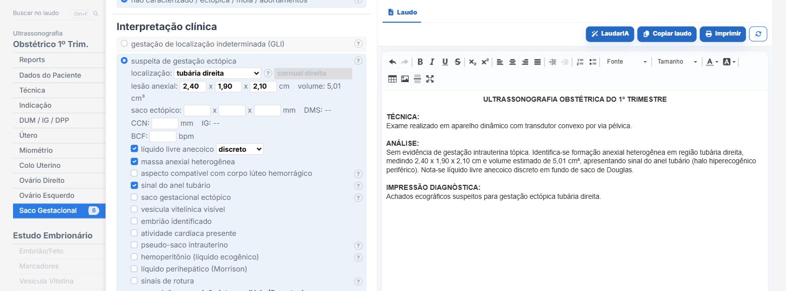Pantalla de Laudário: sospecha de embarazo ectópico