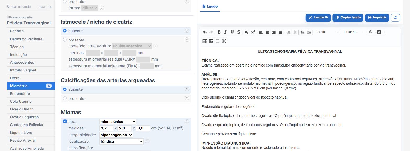 Pantalla de Laudário: mioma mapeado por la clasificación FIGO
