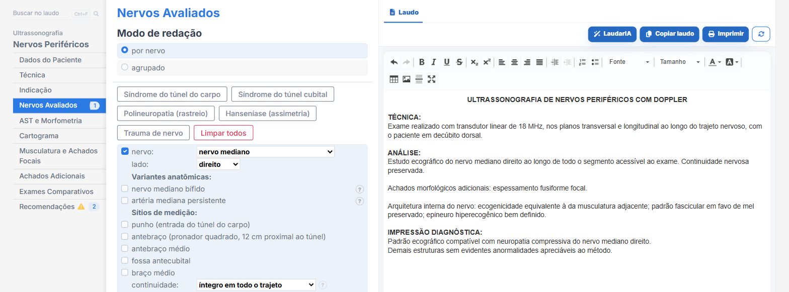 Pantalla de Laudário: nervio mediano en el síndrome del túnel carpiano
