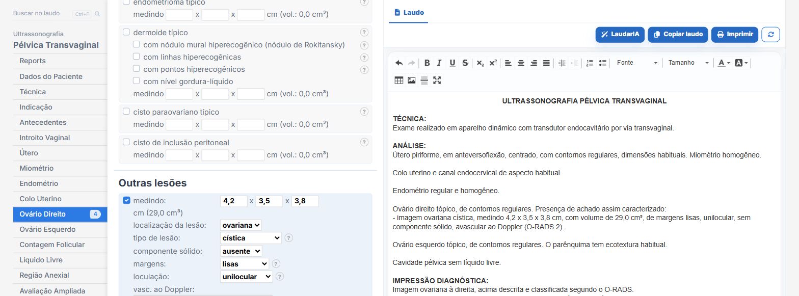 Pantalla de Laudário: lesión ovárica clasificada por O-RADS