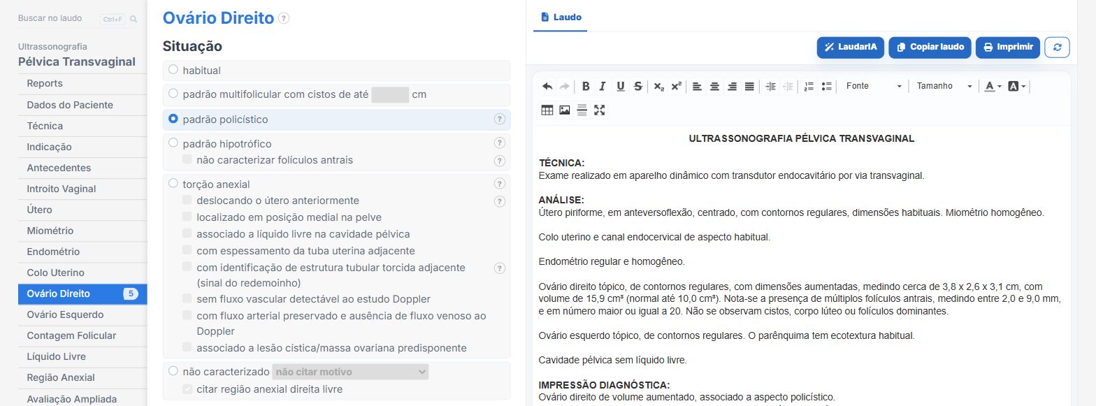 Pantalla de Laudário: ovario de patrón poliquístico