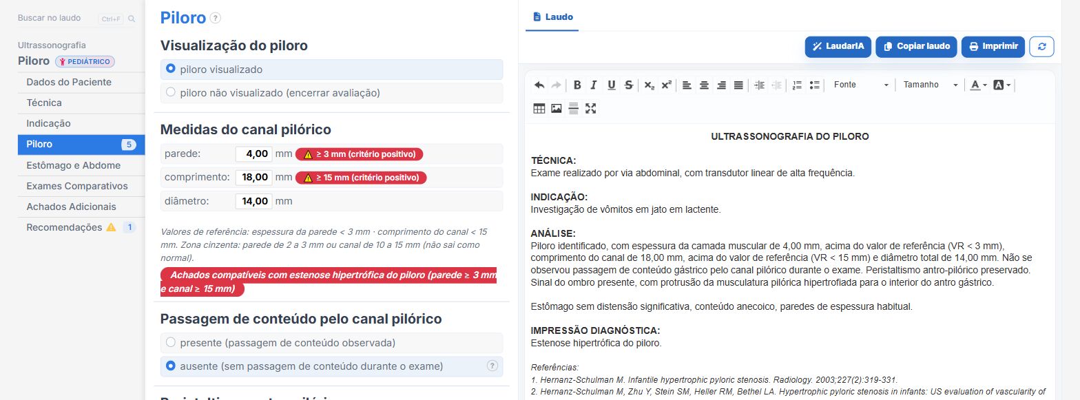 Tela do Laudário: estenose hipertrófica do piloro